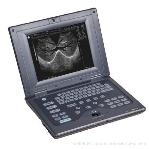 Laptop Full Digital Ultrasound Diagnostic System